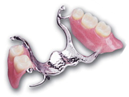 Cast Partial Denture