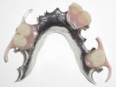 Flexible Denture
