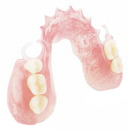 Flexible Denture