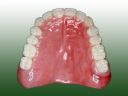 Full Denture Resin