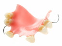Partial Denture