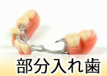 Partial Denture