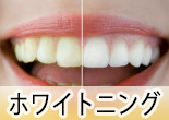 Whitening