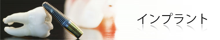インプラント