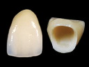 Zirconia Zeramics Crown
